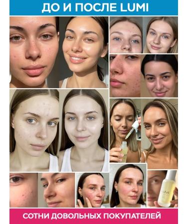 LuMi Facial serum from acne with niacinamide - Buy Online on GoSupps.com