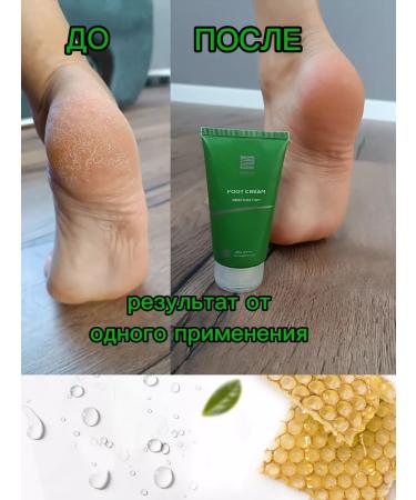 FERZOO Moisturizer for legs and heels with urea 15% - Buy Online on GoSupps.com
