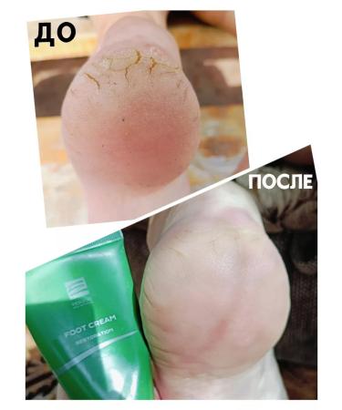 FERZOO Moisturizer for legs and heels with urea 15% - Buy Online on GoSupps.com