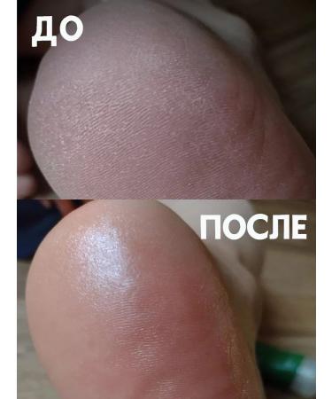 FERZOO Moisturizer for legs and heels with urea 15% - Buy Online on GoSupps.com