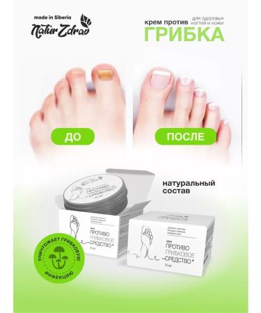 NaturZdrav Cream from nail fungus and skin on the legs natural 75 ml - Buy Online on GoSupps.com