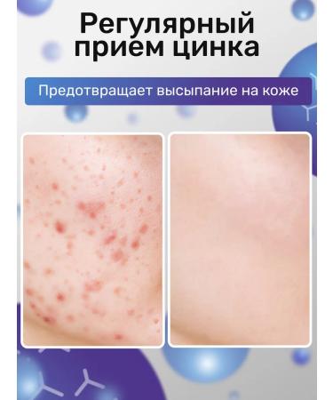 Zinc zink a-bio 100 ml - Buy Online on GoSupps.com