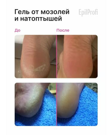 EpilProfi Keratolytic cream for legs and smooth heels - Buy Online on GoSupps.com