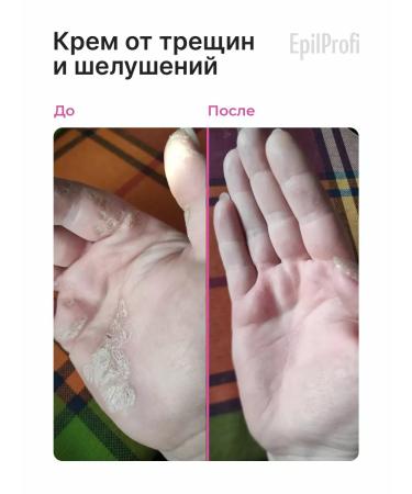 EpilProfi Keratolytic cream for legs and smooth heels - Buy Online on GoSupps.com