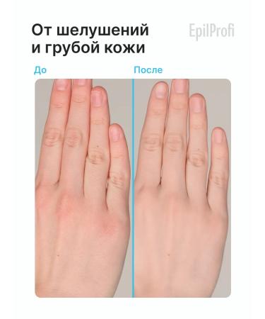 EpilProfi Set for paraffin therapy of arms and legs - Buy Online on GoSupps.com