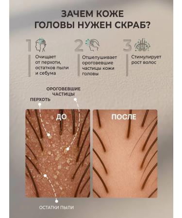 Milzi Scrub from oily for hair growth and scalp cosmetics - Buy Online on GoSupps.com