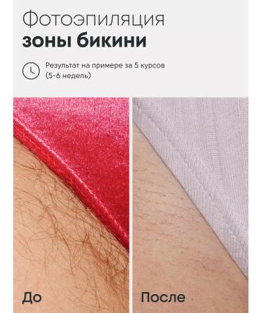 BOER The photoeplator is professional - Buy Online on GoSupps.com