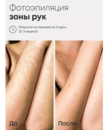 BOER The photoeplator is professional - Buy Online on GoSupps.com