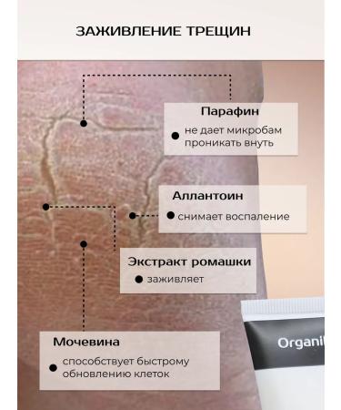Organihuma Cream from urea cracks - Buy Online on GoSupps.com