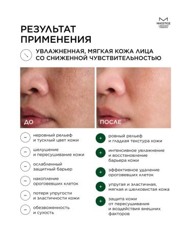 MASSTIGE Piling-serum for the face with acids 30ml - Buy Online on GoSupps.com