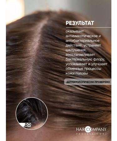 HAIR COMPANY PROFESSIONAL Anti-dandruff hair remedy - Buy Online on GoSupps.com