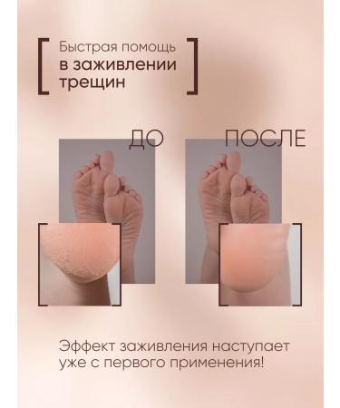 Saiton cosmetic Feet cream from cracks and dry heels - Buy Online on GoSupps.com