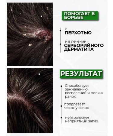 Aesthetic House Shampoo soothing with mint and tea tree extract - Buy Online on GoSupps.com