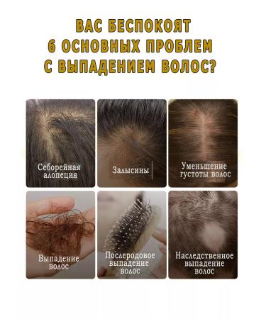 Coolshopping Hair growth serum - Buy Online on GoSupps.com