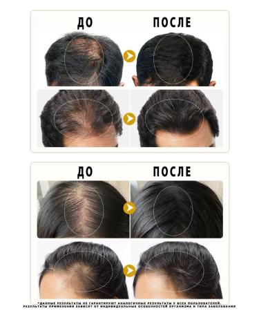 Coolshopping Hair growth serum - Buy Online on GoSupps.com