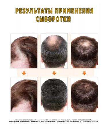 Coolshopping Hair growth serum - Buy Online on GoSupps.com