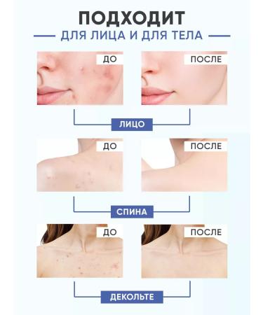 EWAM Acne serum and face acne - Buy Online on GoSupps.com