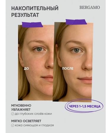 Bergamo Glycolic facial toner moisturizing Korea anti -aging - Buy Online on GoSupps.com