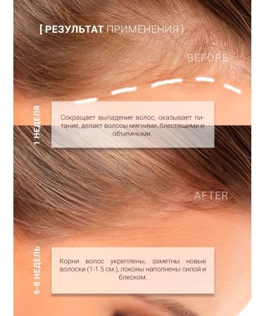 QUEEN'SECRET Sonusufant shampoo with collagen for growth and strengthening - Buy Online on GoSupps.com