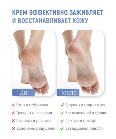 COSMEDICAL Fogs with urea 250 ml - Buy Online on GoSupps.com