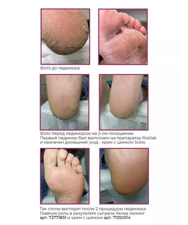ROSILAK Foot Cares "Hyperhidrosis" - Buy Online on GoSupps.com