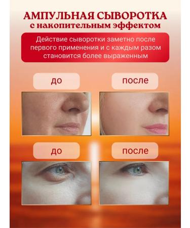 Elizavecca Facial serum from wrinkles Korean - Buy Online on GoSupps.com