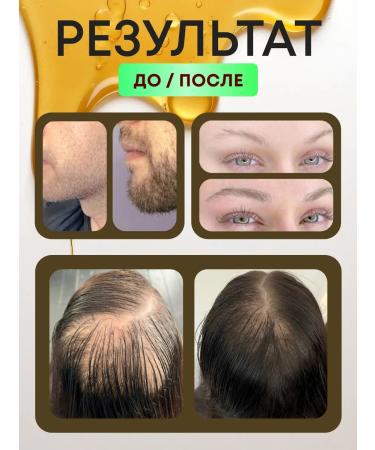 Megazdrav Hair growth serum against falling out and baldness - Buy Online on GoSupps.com