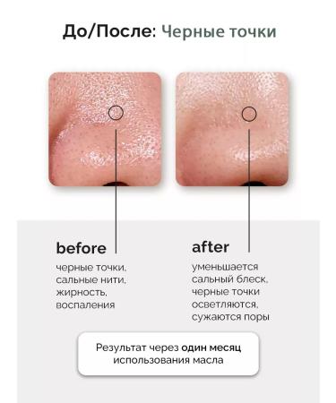 Anua Hearleaf Pore Control Cleansing Oil 200ml hydraulic oil - Buy Online on GoSupps.com