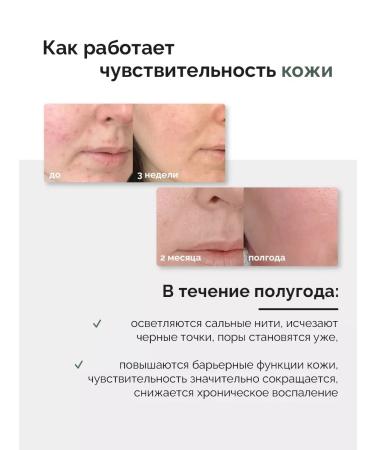 Anua Hearleaf Pore Control Cleansing Oil 200ml hydraulic oil - Buy Online on GoSupps.com