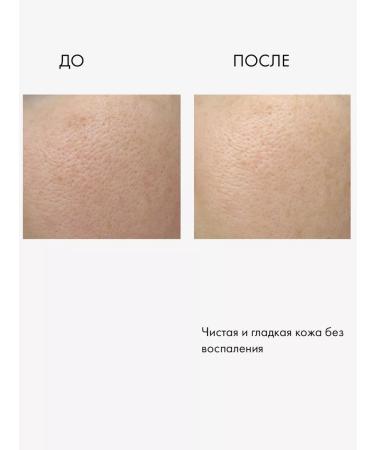 Lamar Professional Milk Peeling Cream-Piling 200 ml - Buy Online on GoSupps.com