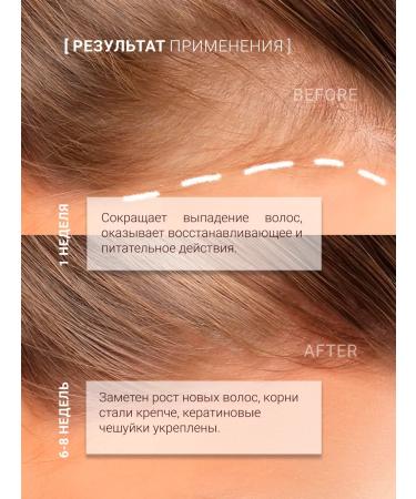 QUEEN'SECRET Natural oil for restoration and hair growth - Buy Online on GoSupps.com