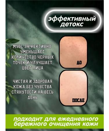 Himalaya Since 1930 Detox Penka-Muss for washing with coal 150ml 2pcs - Buy Online on GoSupps.com