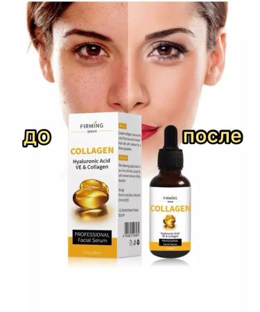 AlexOst Mesoroller 1 mm for the face and serum collagen - Buy Online on GoSupps.com