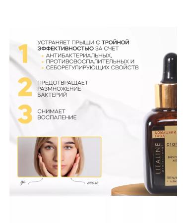 LITALINE Facial serum from acne acne 30ml - Buy Online on GoSupps.com