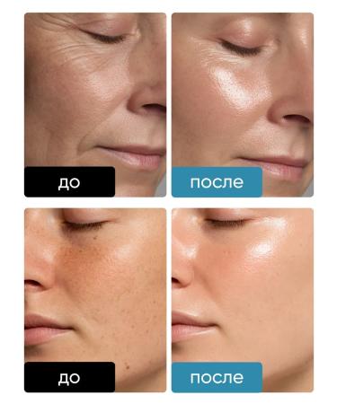 Althea Facial cream with liposomal retinol 0.5% retiderma - Buy Online on GoSupps.com