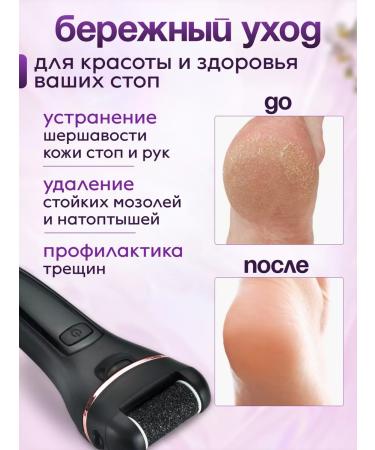 Beauty Feet Feet and heels electric grater for pedicure - Buy Online on GoSupps.com