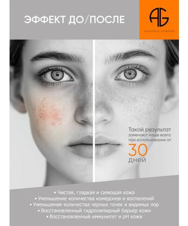 AG ALBINA GLUZMANN Facial tonic anti -inflammatory from acne and acne - Buy Online on GoSupps.com