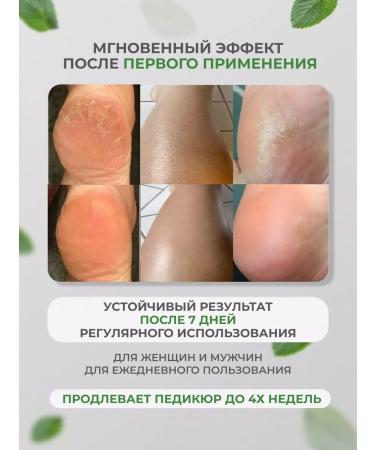 SiFirro Moisturizer with urea - Buy Online on GoSupps.com