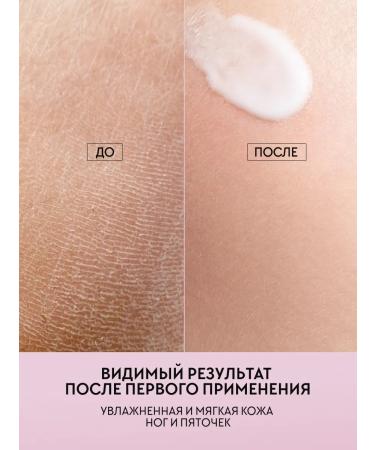 MOREO Moisturizing foot and heel cream - Buy Online on GoSupps.com