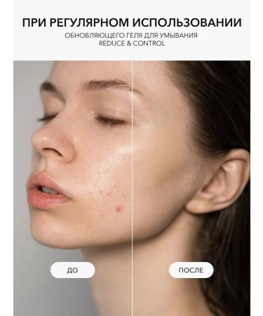 OK Beauty Washing gel for problem skin - Buy Online on GoSupps.com