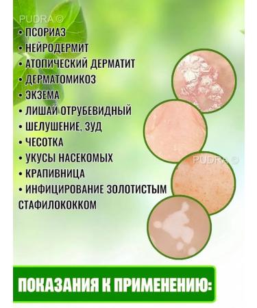 Miracle ointment from psoriasis Zudaifa 15 pcs - Buy Online on GoSupps.com