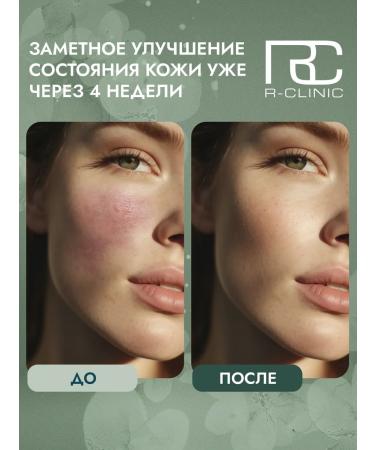 RCLINIC Cleaning tonic for oily and combined skin - Buy Online on GoSupps.com