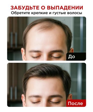 MIXIT Hair growth mask Grow Pro - Buy Online on GoSupps.com