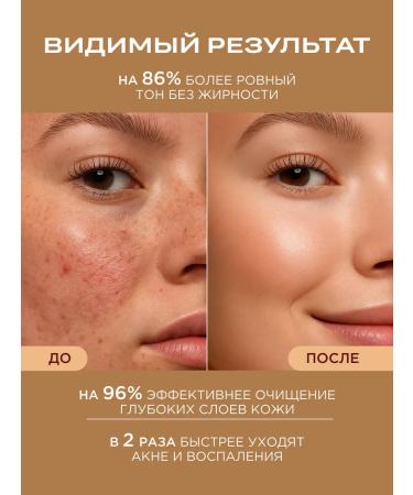 HELDI Gel for washing the face from acne - Buy Online on GoSupps.com