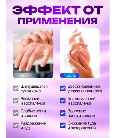 Honey and Jam Psoricon from psoriasis and skin diseases 90 cap - Buy Online on GoSupps.com