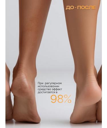 Gehwol Cream for dry skin of feet 125 ml - Buy Online on GoSupps.com