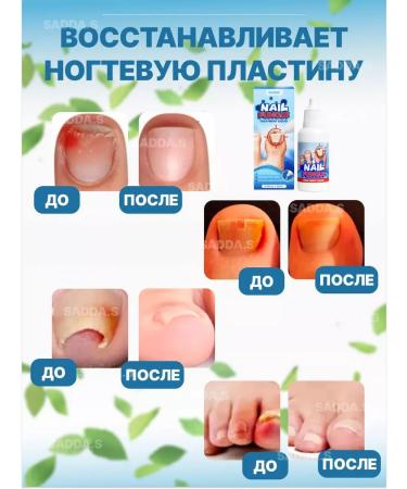 SADDAS Serum from nail fungus - Buy Online on GoSupps.com