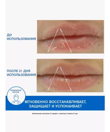 URIAGE Uryazh Balzam Bariederm Cycs Restored 15 ml - Buy Online on GoSupps.com