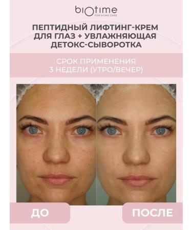 BIOTIME Eye and skin cream around the eyes anti -aging from wrinkles - Buy Online on GoSupps.com