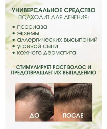 CosmiLab Black hard shampoo against hair loss - Buy Online on GoSupps.com